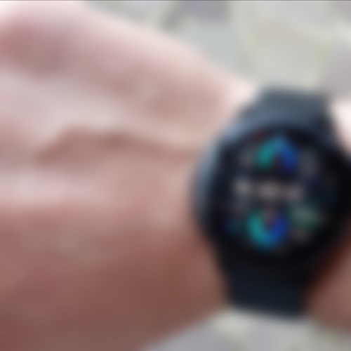 Questo smartwatch cinese è una bomba: ustionato il polso di un bambino in Svizzera